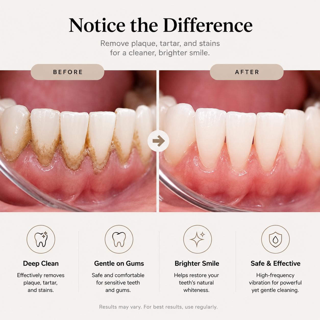 Curvy Moon Ultrasonic Dental Cleaner